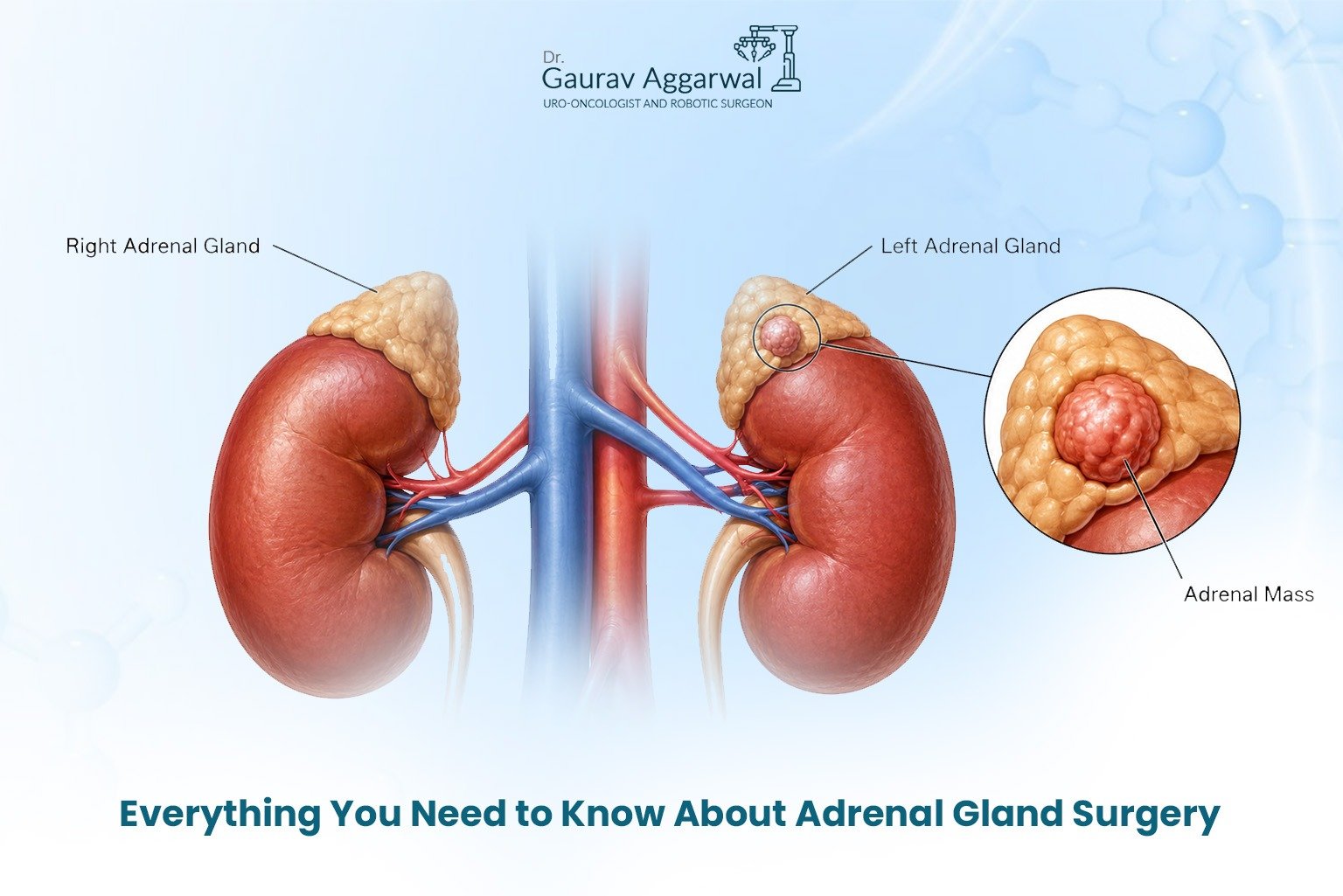 adrenal cancer treatment in Newtown